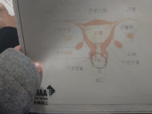 人生初、造影剤MRIで魂がログアウトした話