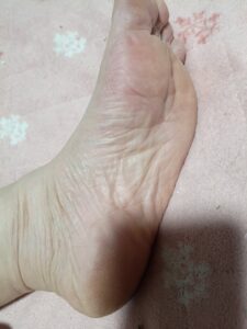 足裏