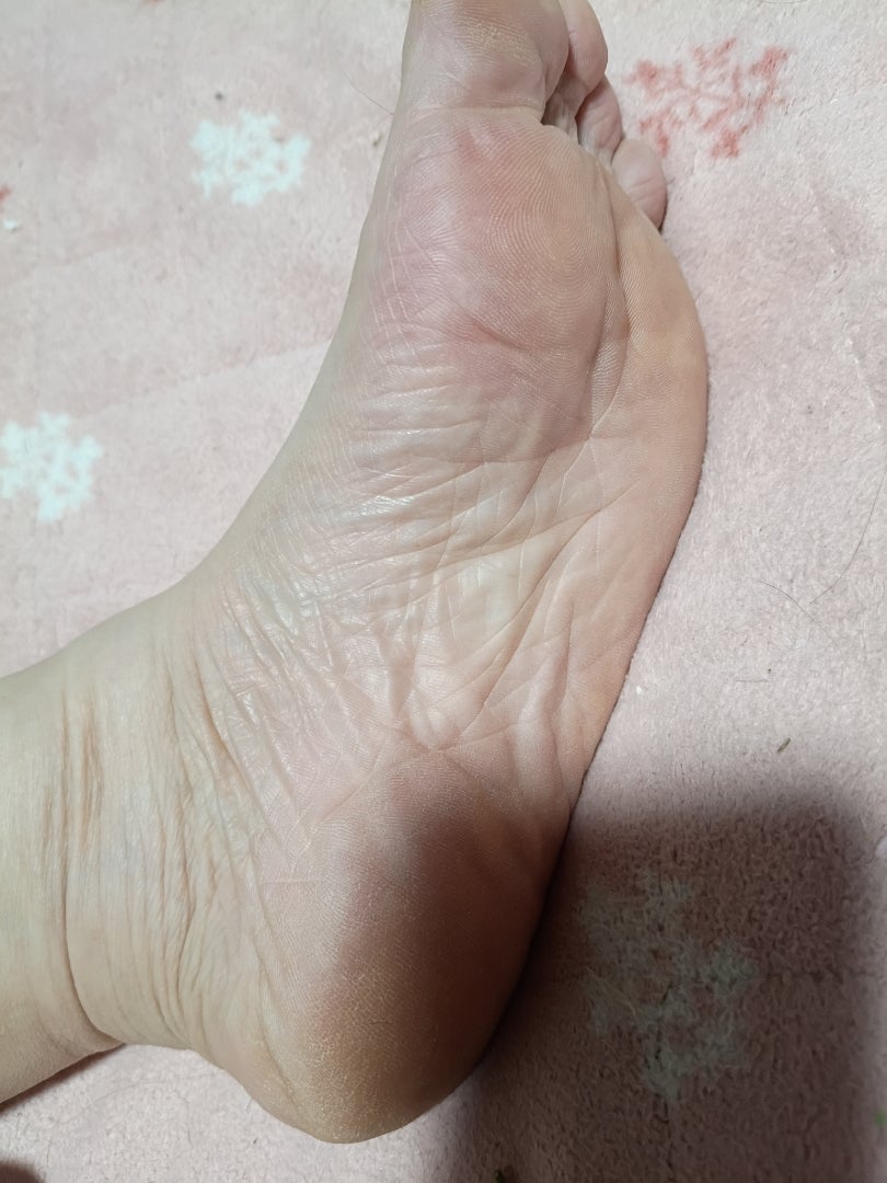 足裏